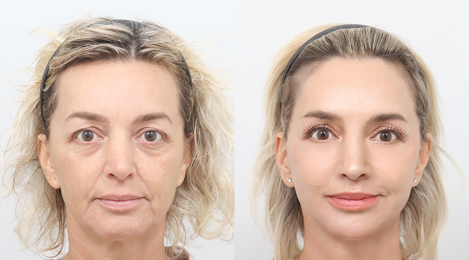 Bella Mae Plastic Surgery